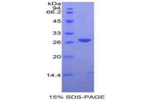 SDS-PAGE analysis of Rat ADAM10 Protein. (ADAM10 Protéine)