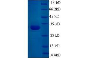 SDS-PAGE (SDS) image for Endothelin Receptor Type A (EDNRA) (AA 39-280) protein (His tag) (ABIN5711018)