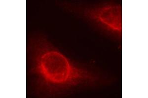 Immunofluorescence staining of methanol-fixed Hela cells, using phospho-CFL1-S3 antibody.