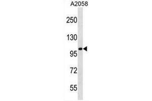 CCDC46 Antibody (N-term) western blot analysis in A2058 cell line lysates (35µg/lane). (CCDC46 anticorps  (N-Term))