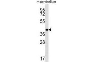 Western Blotting (WB) image for anti-Homeobox D13 (HOXD13) antibody (ABIN2998512) (Homeobox D13 anticorps)