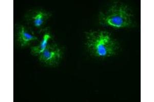 Image no. 5 for anti-Keratin 18 (KRT18) (AA 69-372) antibody (ABIN1491637)