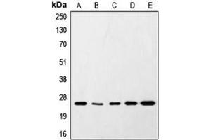 Western blot analysis of SNAP25 expression in HeLa (A), SKNSH (B), RAW264. (SNAP25 anticorps  (C-Term))