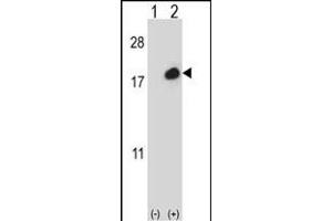 Western blot analysis of ISG15 (arrow) using rabbit polyclonal ISG15 Antibody (C-term ) (ABIN387984 and ABIN2844985). (ISG15 anticorps  (C-Term))