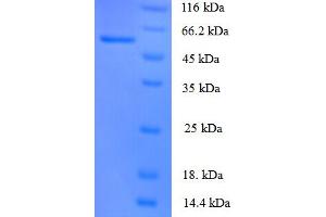 SDS-PAGE (SDS) image for Angiopoietin 1 (ANGPT1) (AA 16-498) protein (His tag) (ABIN5711317)