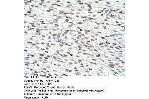 Rabbit Anti-HNRPAB Antibody  Paraffin Embedded Tissue: Human Heart Cellular Data: Myocardial cells Antibody Concentration: 4. (HNRNPAB anticorps  (C-Term))