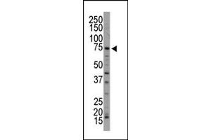 Western Blotting (WB) image for anti-NUAK Family, SNF1-Like Kinase, 1 (NUAK1) (C-Term) antibody (ABIN360528) (NUAK1 anticorps  (C-Term))