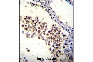 DOK3 Antibody (C-term) (ABIN655979 and ABIN2845363) immunohistochemistry analysis in formalin fixed and paraffin embedded human lung tissue followed by peroxidase conjugation of the secondary antibody and DAB staining.