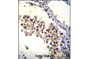 DOK3 Antibody (C-term) (ABIN655979 and ABIN2845363) immunohistochemistry analysis in formalin fixed and paraffin embedded human lung tissue followed by peroxidase conjugation of the secondary antibody and DAB staining. (DOK3 anticorps  (C-Term))