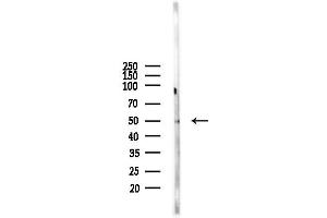Western blot analysis of lysates from  cells(starvation,24h treatment), using TRIM38 Antibody at 1/1000 dilution.