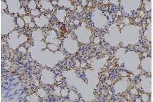 ABIN6276534 at 1/100 staining Mouse lung tissue by IHC-P.