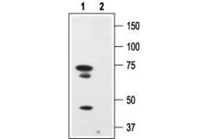 Western blot analysis of human melanoma cells A875:1. (Nerve Growth Factor Receptor (NGFR) Peptide)