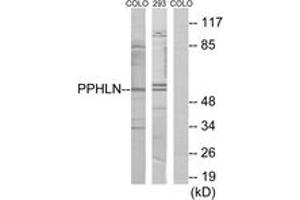Western blot analysis of extracts from COLO/293 cells, using PPHLN Antibody. (PPHLN1 anticorps  (AA 71-120))