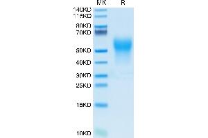 Biotinylated Human IL-18BP on Tris-Bis PAGE under reduced condition.