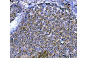 IHC analysis of MSF/SEPTIN9 using anti-MSF/SEPTIN9 antibody (ABIN7600104). (Septin 9 anticorps  (AA 15-282))