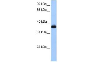 ERI2 antibody used at 1 ug/ml to detect target protein. (ERI2 anticorps  (Middle Region))