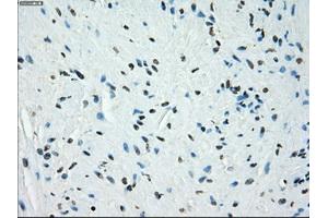 Immunohistochemical staining of paraffin-embedded endometrium tissue using anti-KDM4C mouse monoclonal antibody. (KDM4C anticorps)
