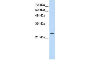 Troponin I Type 1 antibody used at 0. (TNNI1 anticorps)