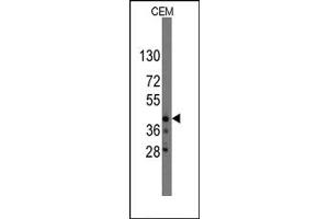 Image no. 1 for anti-Protein Quaking (QKI) (N-Term) antibody (ABIN357831)