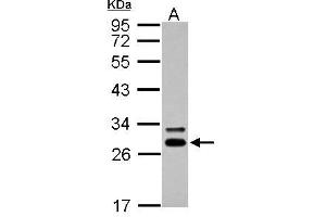 WB Image Sample (30 ug of whole cell lysate) A: A431 12% SDS PAGE antibody diluted at 1:5000 (DCK anticorps  (Center))