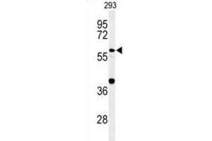 Western Blotting (WB) image for anti-Cell Division Cycle 45 Homolog (S. Cerevisiae) (CDC45) antibody (ABIN3004359) (CDC45 anticorps)