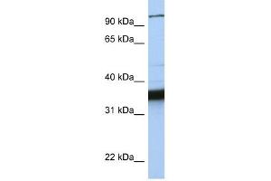 KIFC3 antibody used at 1 ug/ml to detect target protein. (KIFC3 anticorps  (C-Term))