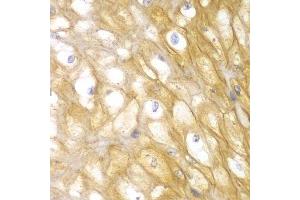 Immunohistochemistry of paraffin-embedded human esophagus using ACTN1 antibody.