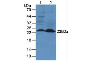 Figure. (Lipocalin 2 anticorps  (AA 21-200))