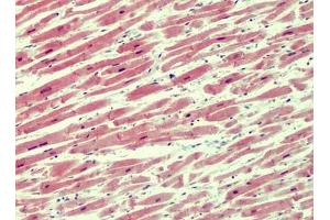 Human Heart: Formalin-Fixed, Paraffin-Embedded (FFPE) (IRAK4 anticorps  (N-Term))