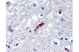 Anti-Myelin Basic Protein antibody IHC of human brain, oligodendrocytes. (MBP anticorps  (AA 130-136))