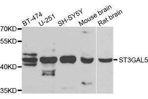 Western blot analysis of extracts of various cell lines, using ST3GAL5 antibody. (ST3GAL5 anticorps)