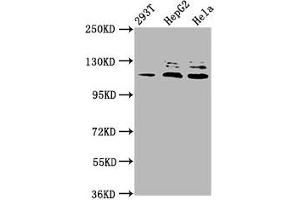 Western Blot Positive WB detected in: 293T whole cell lysate, HepG2 whole cell lysate, Hela whole cell lysate All lanes: MAP3K21 antibody at 3. (MLK4 anticorps  (AA 640-794))