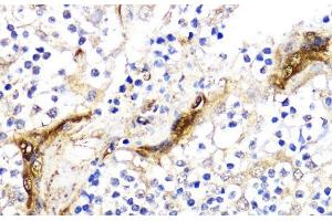 Immunohistochemistry of paraffin-embedded Human tonsil using BMPR1B Polyclonal Antibody at dilution of 1:200 (40x lens).
