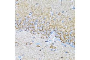 Immunohistochemistry of paraffin-embedded mouse brain using MAP1LC3B antibody (ABIN5973262) at dilution of 1/100 (40x lens). (LC3B anticorps)