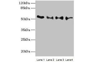 Western blot All lanes: TRIM15 antibody at 2 μg/mL Lane 1: Jurkat whole cell lysate Lane 2: Hela whole cell lysate Lane 3: HepG2 whole cell lysate Lane 4: A549 whole cell lysate Secondary Goat polyclonal to rabbit IgG at 1/10000 dilution Predicted band size: 53, 13 kDa Observed band size: 53 kDa (TRIM15 anticorps  (AA 122-387))