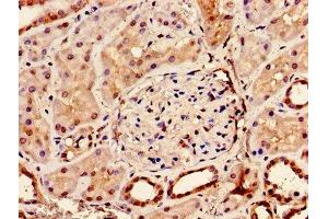 Immunohistochemistry of paraffin-embedded human kidney tissue using ABIN7145700 at dilution of 1:100