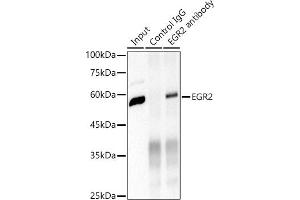 Immunoprecipitation analysis of 600 μg extracts of Mouse brain cells using 3 μg EGR2 antibody (ABIN1682321, ABIN7101509, ABIN7101510 and ABIN7101511).