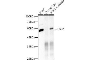 Immunoprecipitation analysis of 600 μg extracts of Mouse brain cells using 3 μg EGR2 antibody (ABIN1682321, ABIN7101509, ABIN7101510 and ABIN7101511). (EGR2 anticorps)
