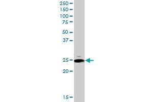ARHGDIA MaxPab rabbit polyclonal antibody. (ARHGDIA anticorps  (AA 1-204))