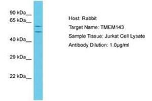 Image no. 1 for anti-Transmembrane Protein 143 (TMEM143) (C-Term) antibody (ABIN6750626) (TMEM143 anticorps  (C-Term))
