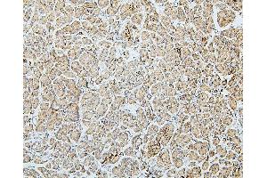 IHC analysis of MTR using anti-MTR antibody (ABIN7602599).