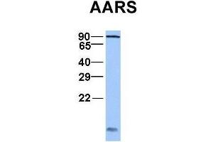 Host:  Rabbit  Target Name:  AARS  Sample Type:  Jurkat  Antibody Dilution:  1. (AARS anticorps  (C-Term))