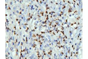 IHC analysis of LBR using anti-LBR antibody (ABIN6719340). (Lamin B Receptor anticorps  (AA 102-209))