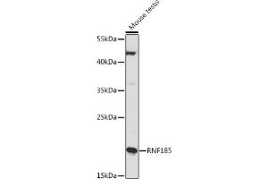 Western blot analysis of extracts of Mouse testis, using RNF185 Rabbit pAb (ABIN7270068) at 1:1000 dilution. (RNF185 anticorps  (AA 1-130))
