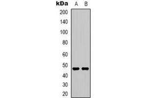 Western blot analysis of 5-HT2C expression in SHSY5Y (A), NIH3T3 (B) whole cell lysates. (HTR2C anticorps)