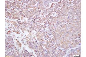 anti-Reticulon 4 Receptor-Like 2 (RTN4RL2) (AA 241-337) antibody