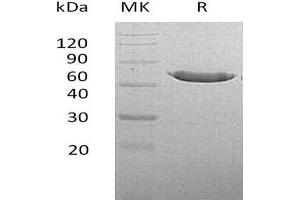 Western Blotting (WB) image for Carboxypeptidase A2 (Pancreatic) (CPA2) protein (His tag) (ABIN7320703)