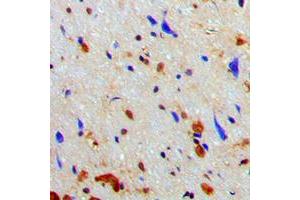 Immunohistochemical analysis of NAA15 staining in human brain formalin fixed paraffin embedded tissue section. (NAA15 anticorps  (Center))