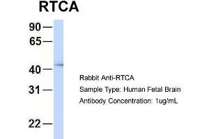 Host: Rabbit Target Name: RTCA Sample Type: Human Fetal Brain Antibody Dilution: 1. (RTCD1 anticorps  (N-Term))
