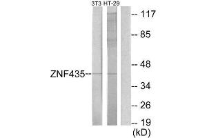 Western Blotting (WB) image for anti-Zinc Finger and SCAN Domain Containing 16 (ZSCAN16) (Internal Region) antibody (ABIN1849977) (ZSCAN16 anticorps  (Internal Region))